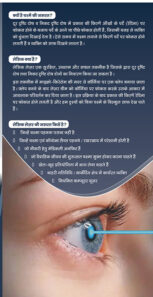 Lasik-2