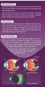 RETINAL-DETACHMENT-2