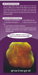 RETINAL-DETACHMENT-3