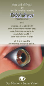 keratoconus-1