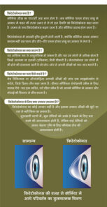 keratoconus-2